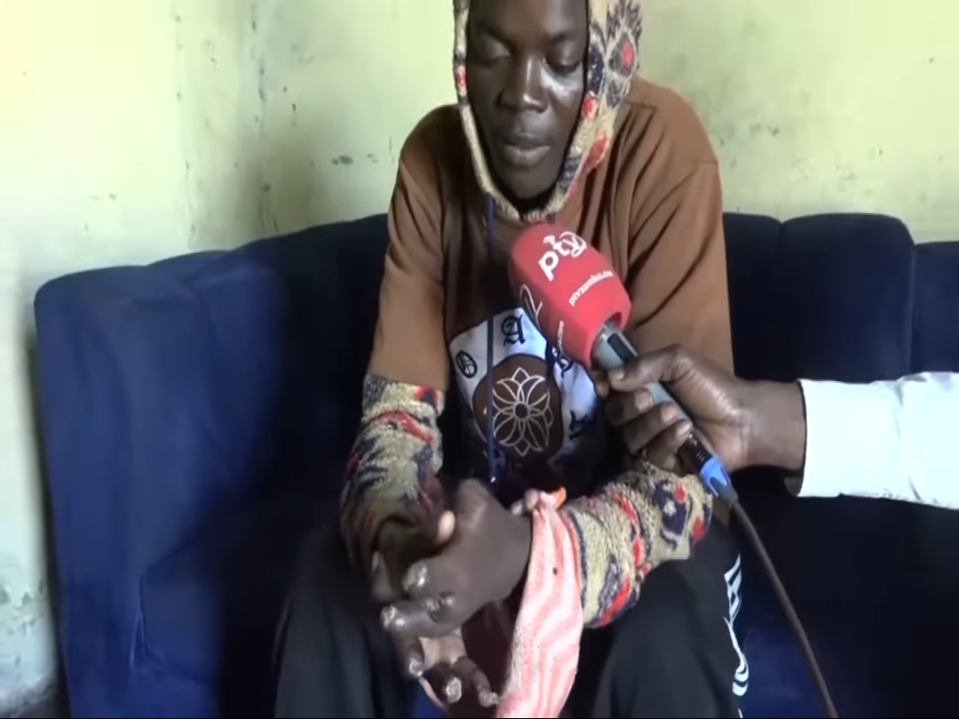 18-Year-Old Lusaka Worker Loses Eight Fingers Days After Starting Job, Rejects K50,000 Compensation